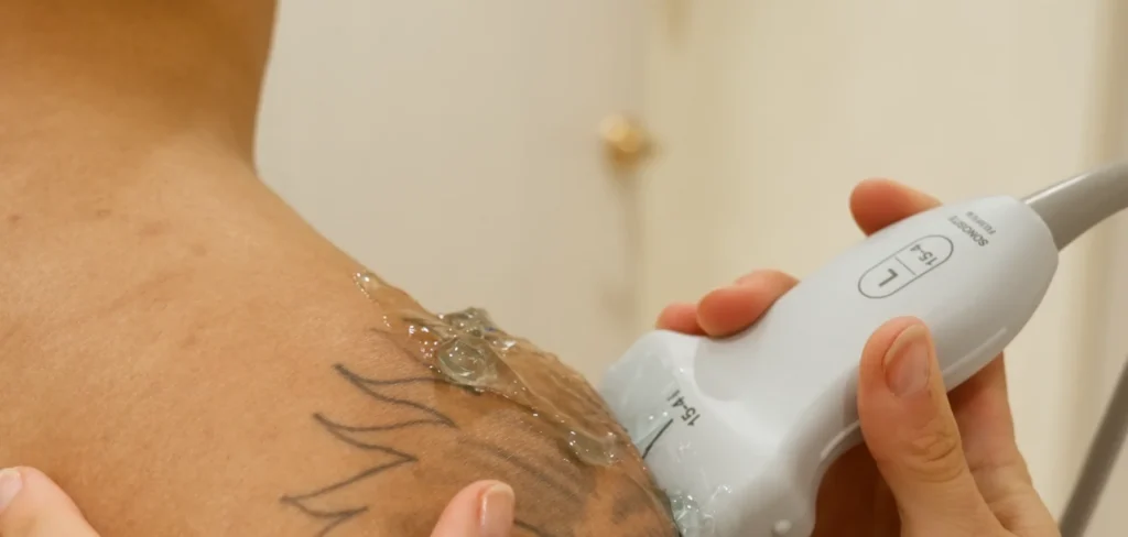 Ultrasound probe guiding a shoulder assessment for prolotherapy at Renova Total Health