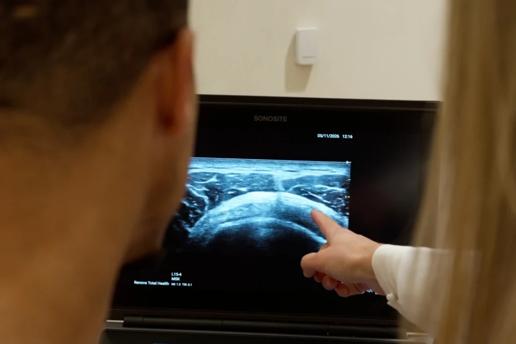 Provider reviewing a shoulder ultrasound image with a patient before prolotherapy at Renova Total Health