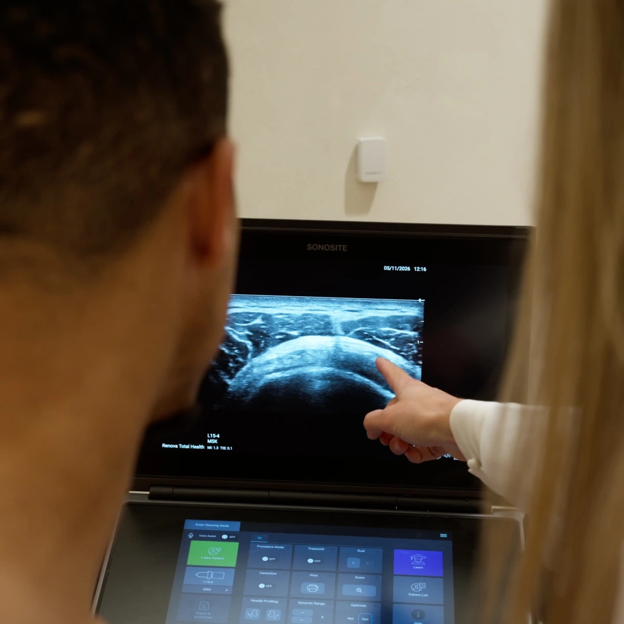 Provider pointing to a live ultrasound image during an ultrasound-guided joint assessment at Renova Total Health